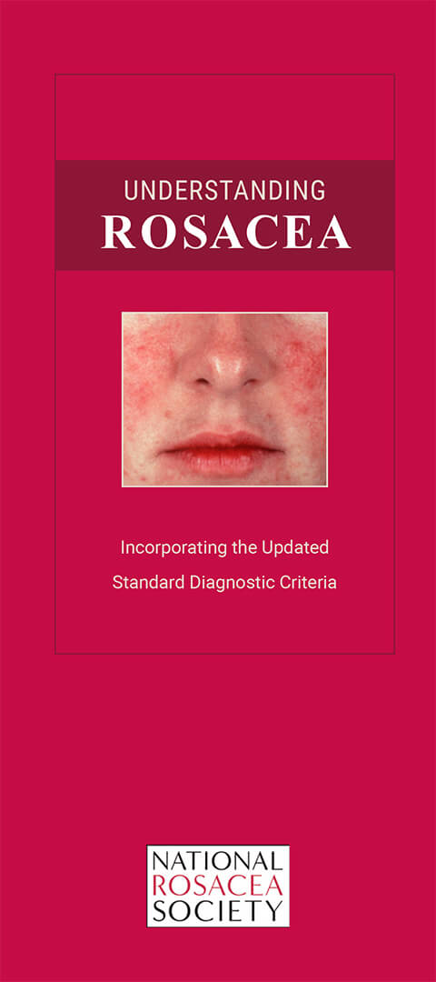 Understanding Rosacea booklet