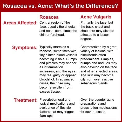 Rash On Back Looks Like Acne - Doctor insights on HealthTap