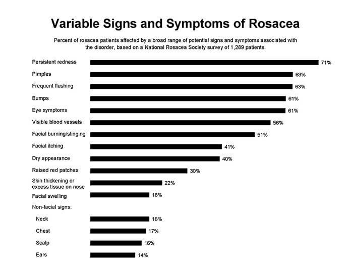 Variable Signs and Symptoms of Rosacea chart