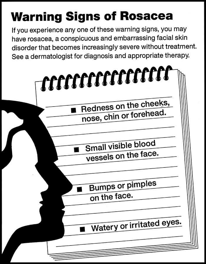 Warning of Rosacea chart