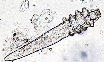 Demodex Folliculorum