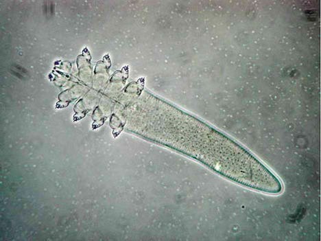 Demodex folliculorum