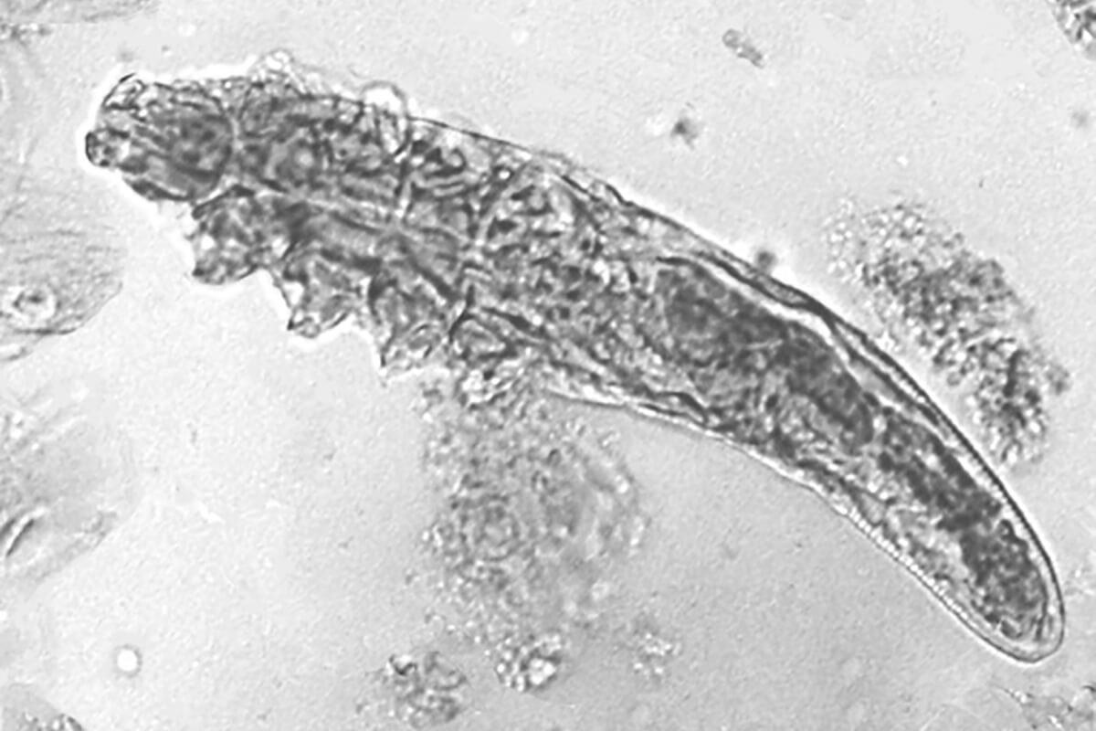 Demodex folliculorum mite