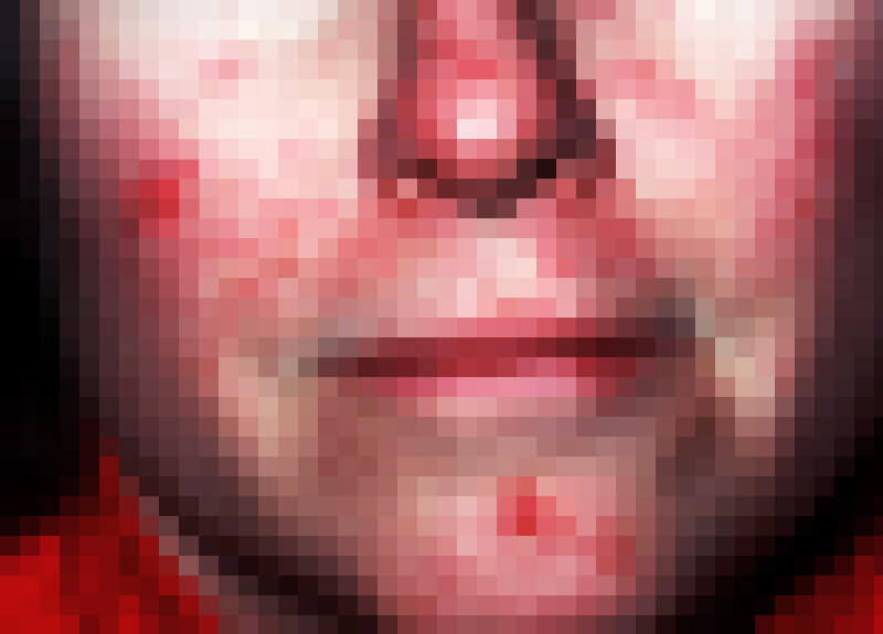 pixelated face with rosacea