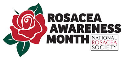 Rosacea Awareness Month