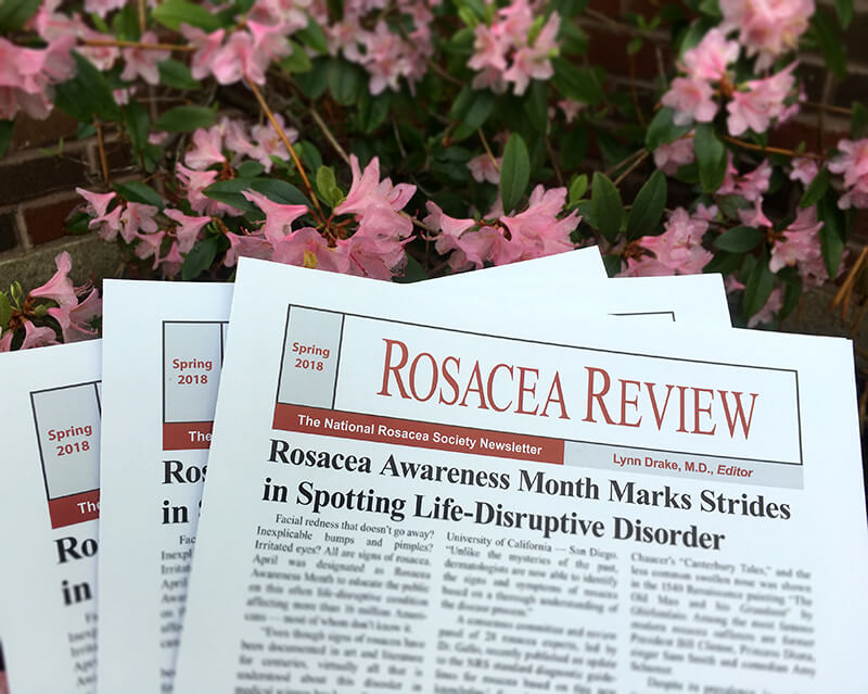 Rosacea Review Spring 2018