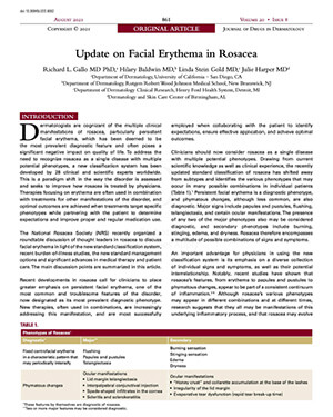Update on Facial Erythema in Rosacea