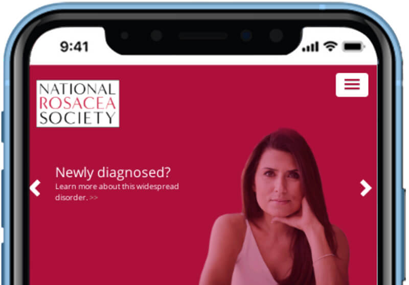 mobile-oriented website rosacea.org