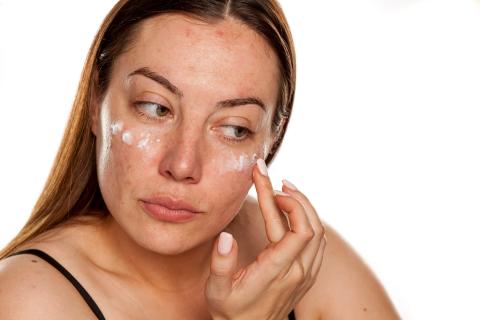 woman applying cream to her face