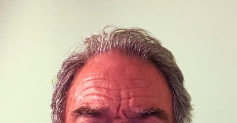 man with receding hairline