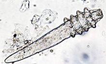 Demodex folliculorum