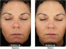 Senté Dermal Repair Cream